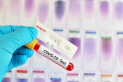 Coronavirus test