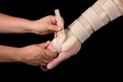 Carpal tunnel syndrome