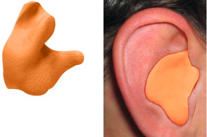 DIY Custom Earplug Kit - EAR Customized Hearing Protection