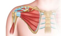 Shoulder pain