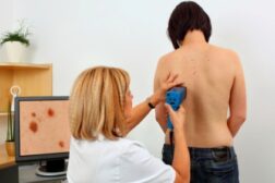 skin cancer examination